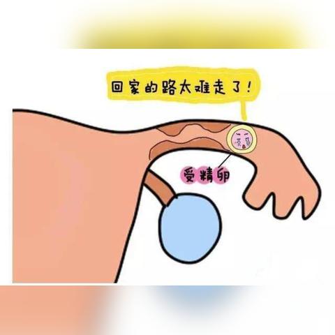 (hcg检查是什么意思啊)HCG是检查什么项目？高效综合性用途涵盖的检查内容是什么？