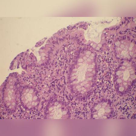 拯救细胞手游:挑战极限,探索神秘细胞世界,激发你的策略智慧与勇气 拯救细胞手游:挑战极限,探索神秘细胞世界,激发你的策略智慧与勇气